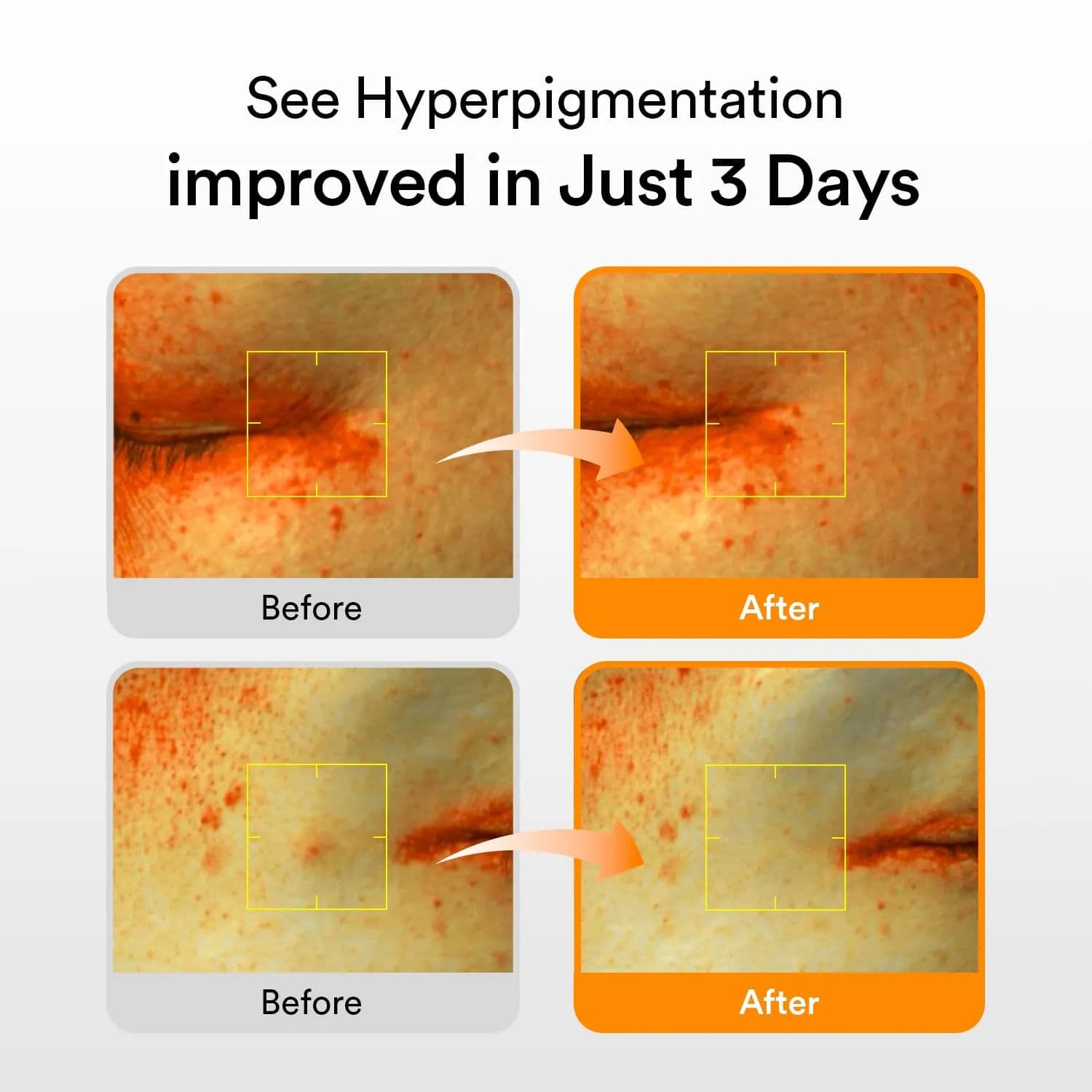 Glutathiosome Dark Spot Serum Vita Drop 7