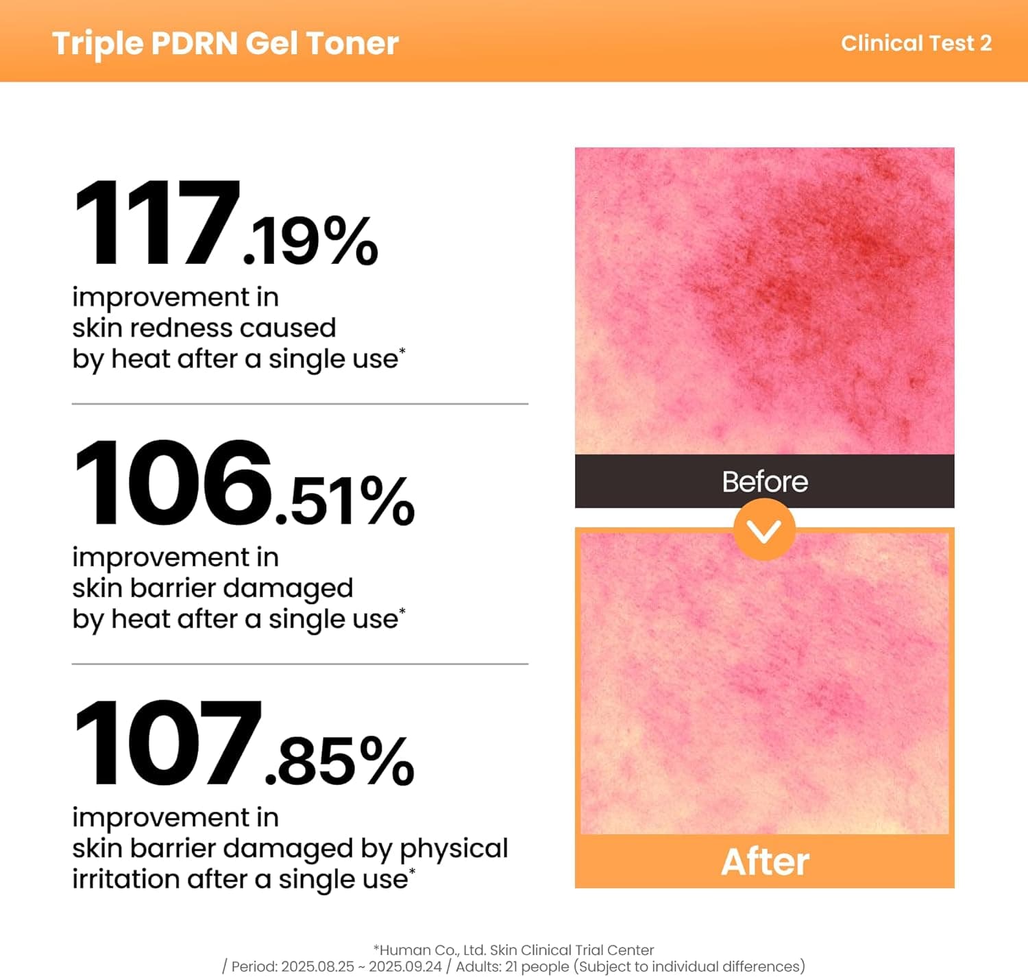 Triple PDRN Gel Toner 5