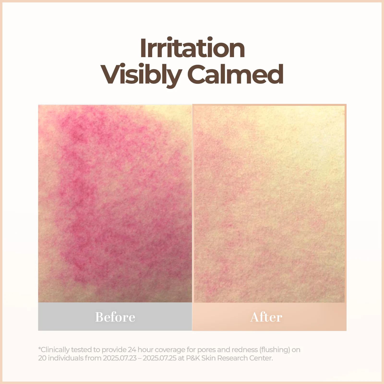 Skin Blemish Balm Intensive 7