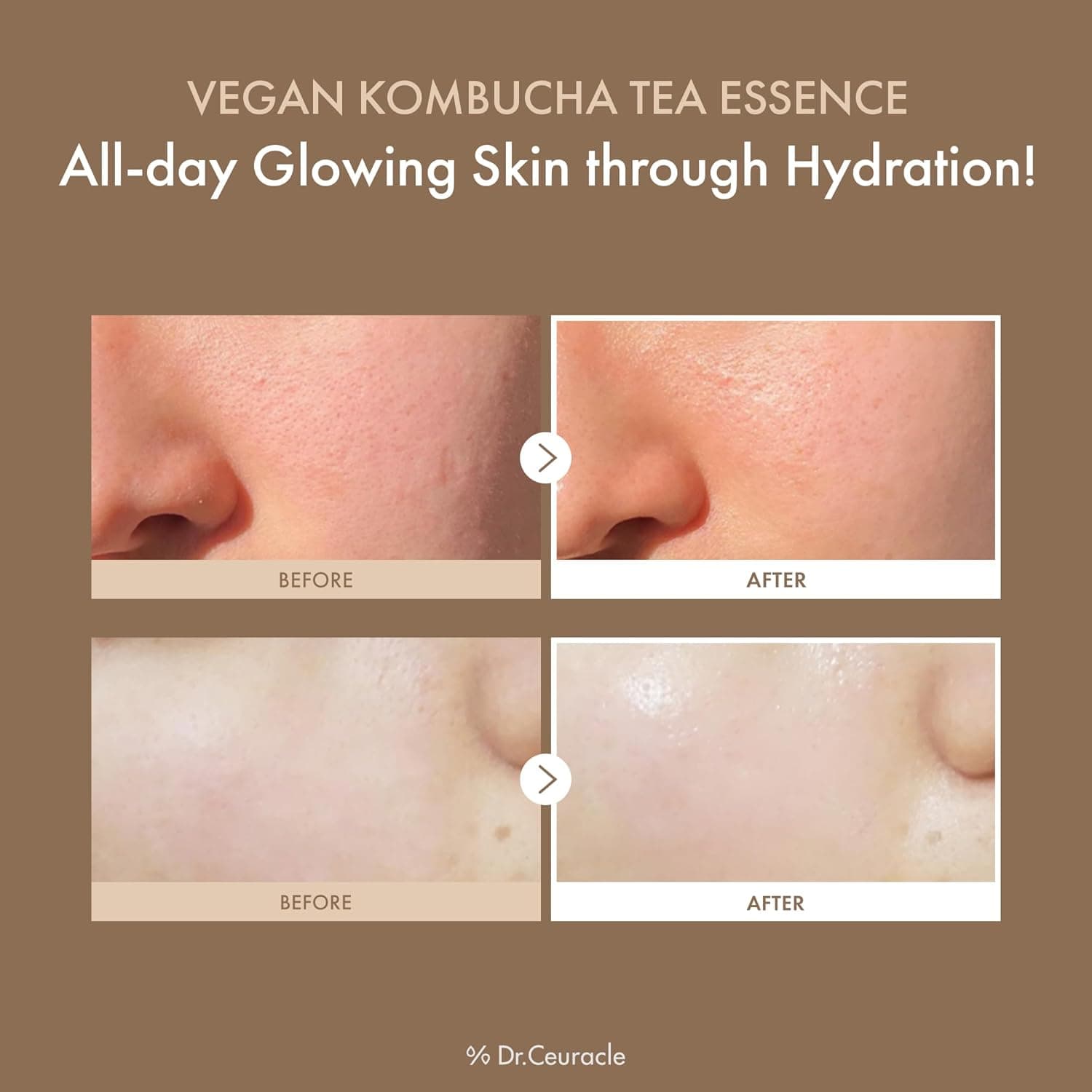 Vegan Kombucha Tea Essence 3