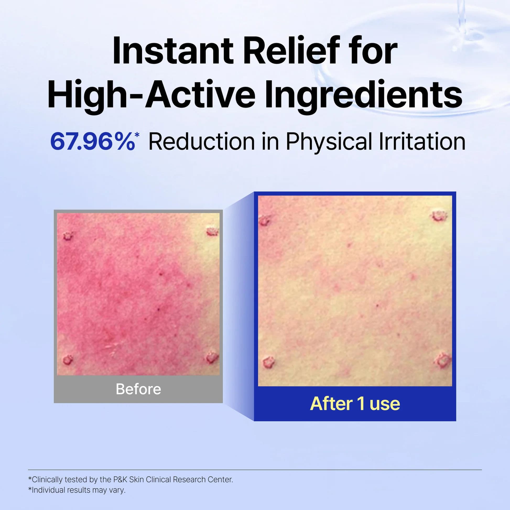 Supple Preparation Unscented Facial Toner 5