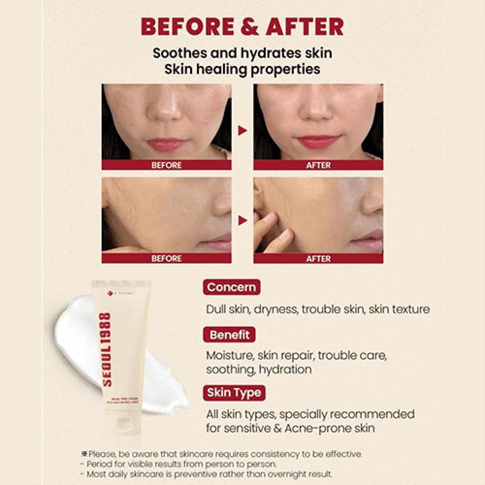 SEOUL 1988 Cream : Snail Mucin 93% + Rice 3