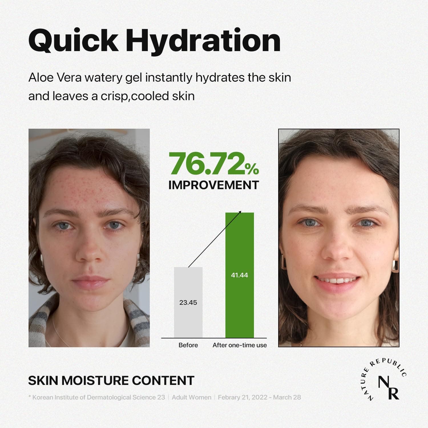 Soothing & Moisture Aloe Vera 92% Soothing Gel 5