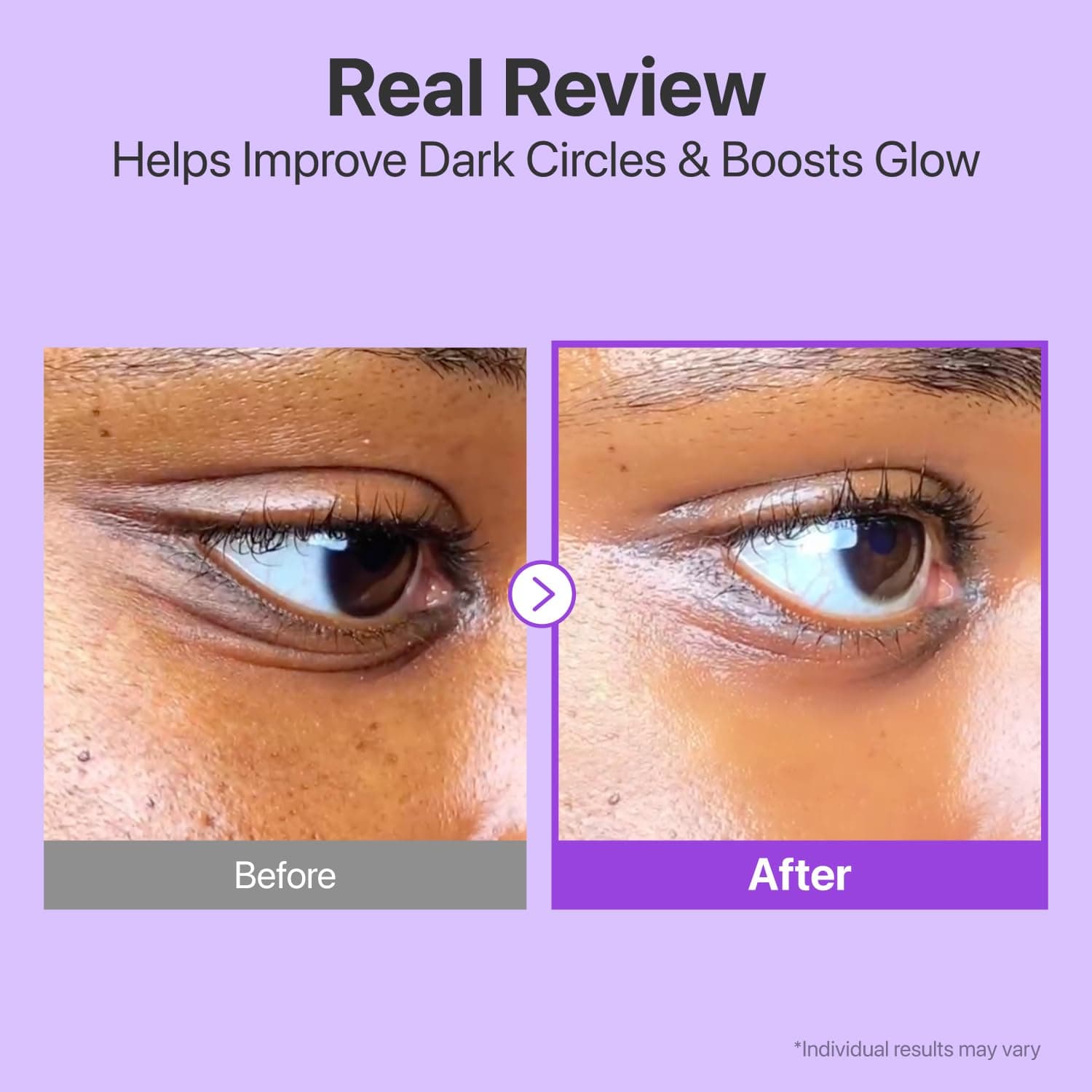 No.9 NAD+ Retinal Volumetox Eye Cream Tube Type 3
