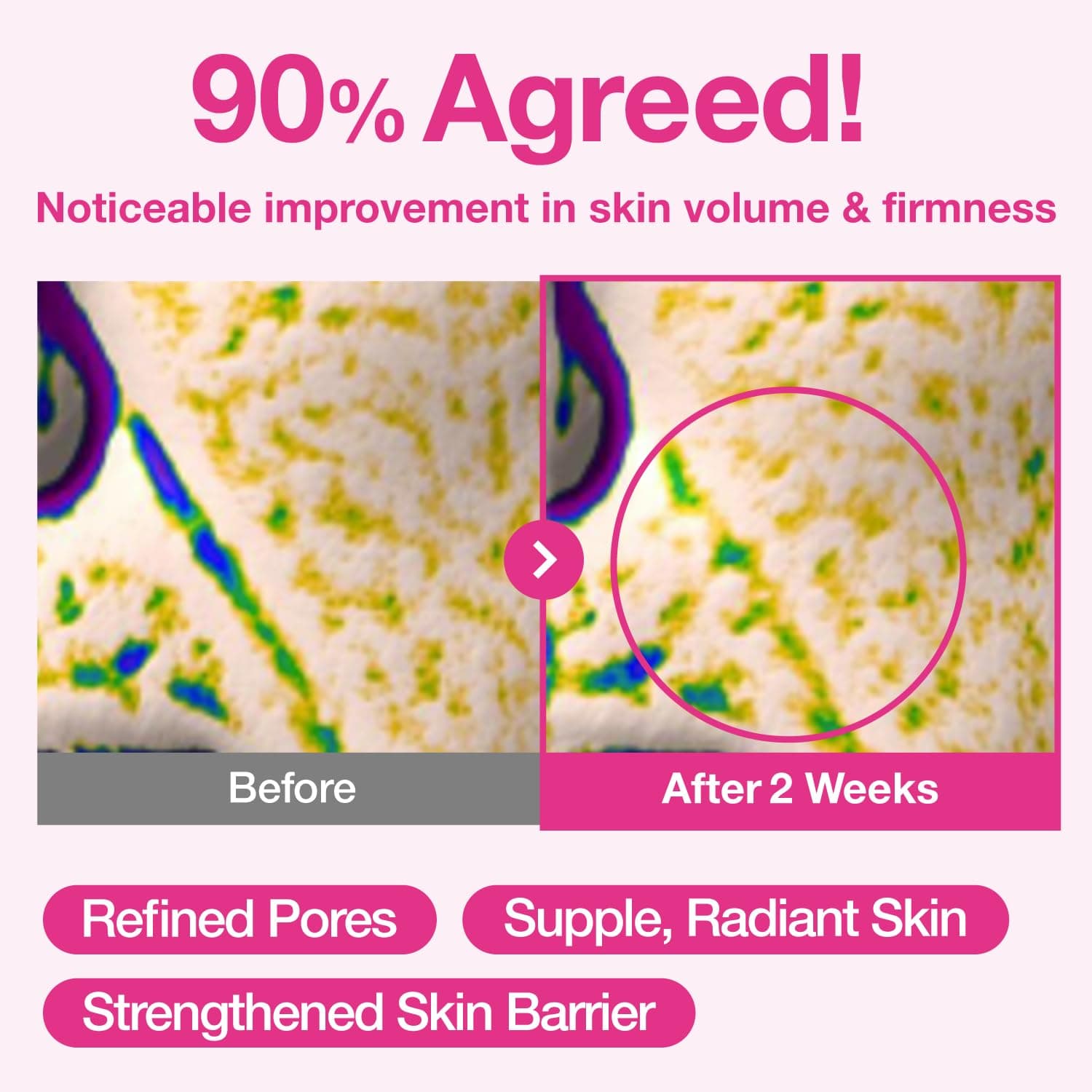 No.2 Rose PDRN Collagen Plumping Sheet Mask 4