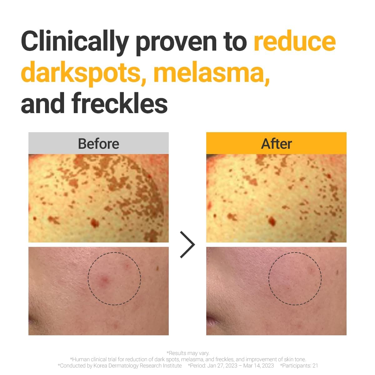 Vita Dark Spot Serum 4