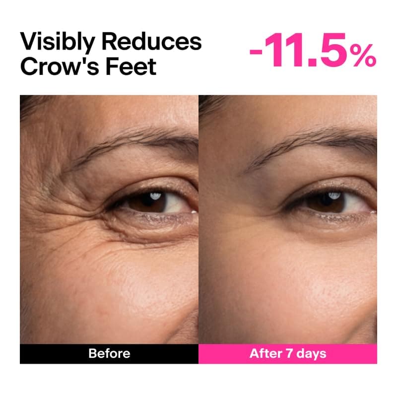 CPR Triple-Synergy Wrinkle Care Serum 6