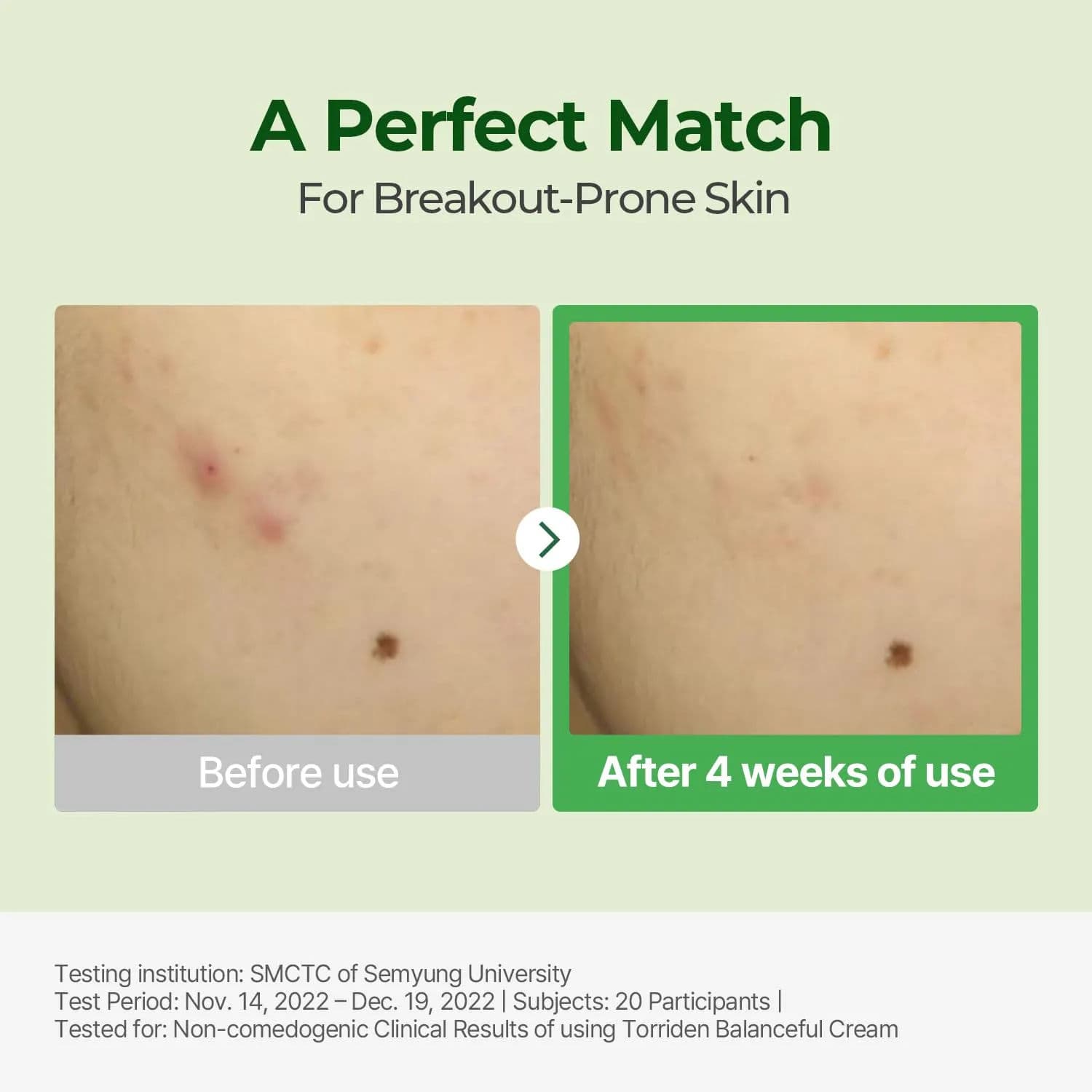 Balanceful Cica Cream 3