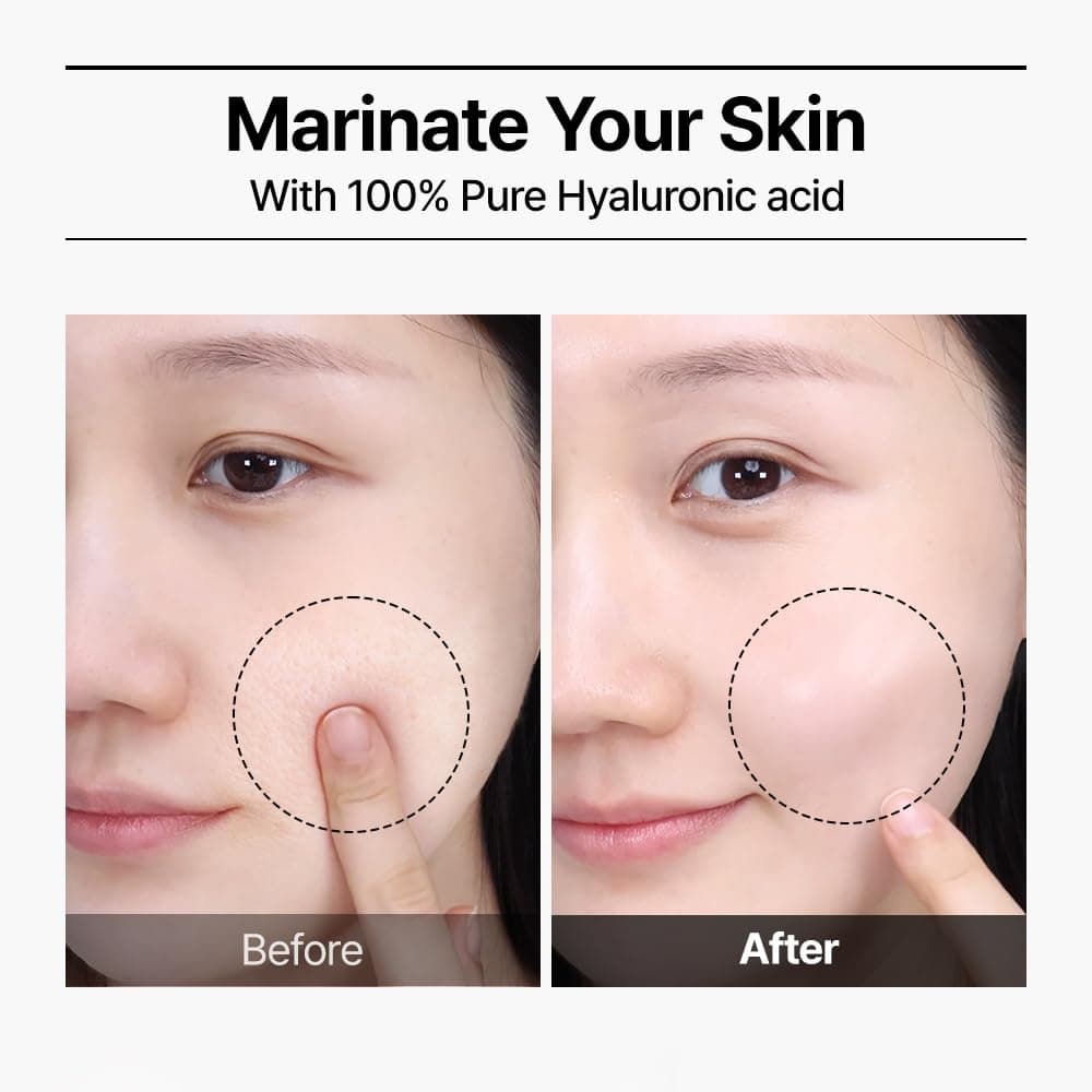 Real Hyaluronic Blue 100 Ampoule 3