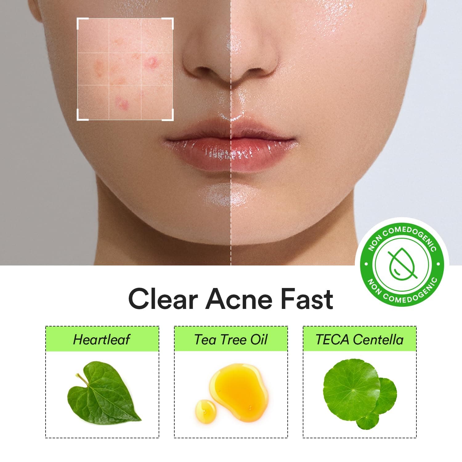 Heartleaf Calming Spot Patch 3