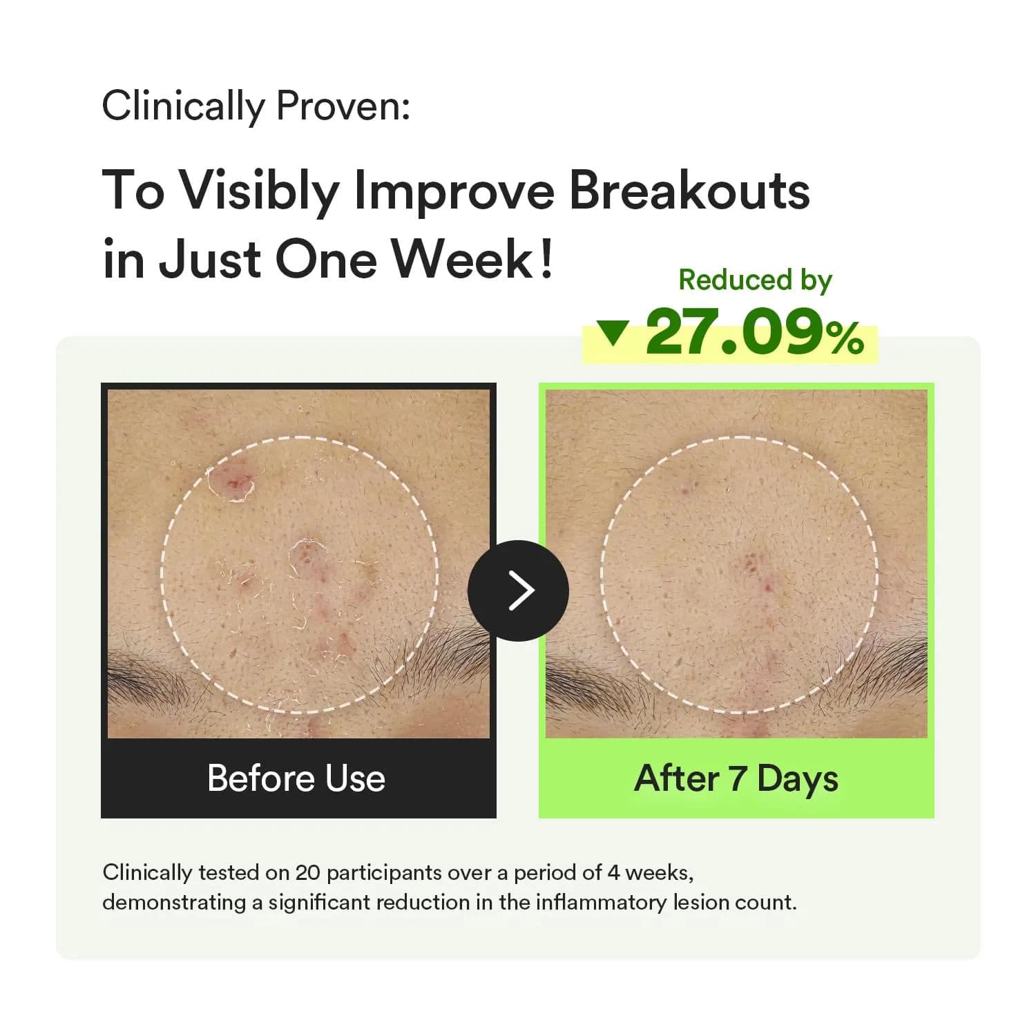 Heartleaf TECA Capsule Serum Calming Drop 6