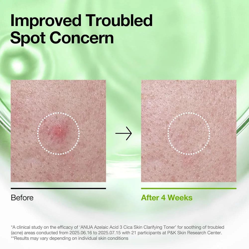 Azelaic Acid 3 Cica Skin Clarifying Toner 3