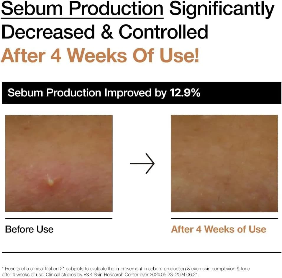 Rice 70 Glow Milky Toner 3