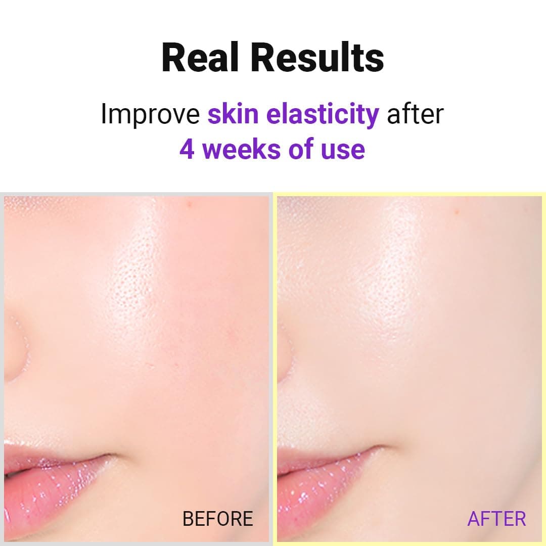 Hyper Retinol EX 1.0 Serum 5