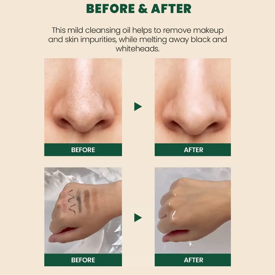 SEOUL 1988 Cleansing Oil : Pine Cica 1% + Probiotics 5