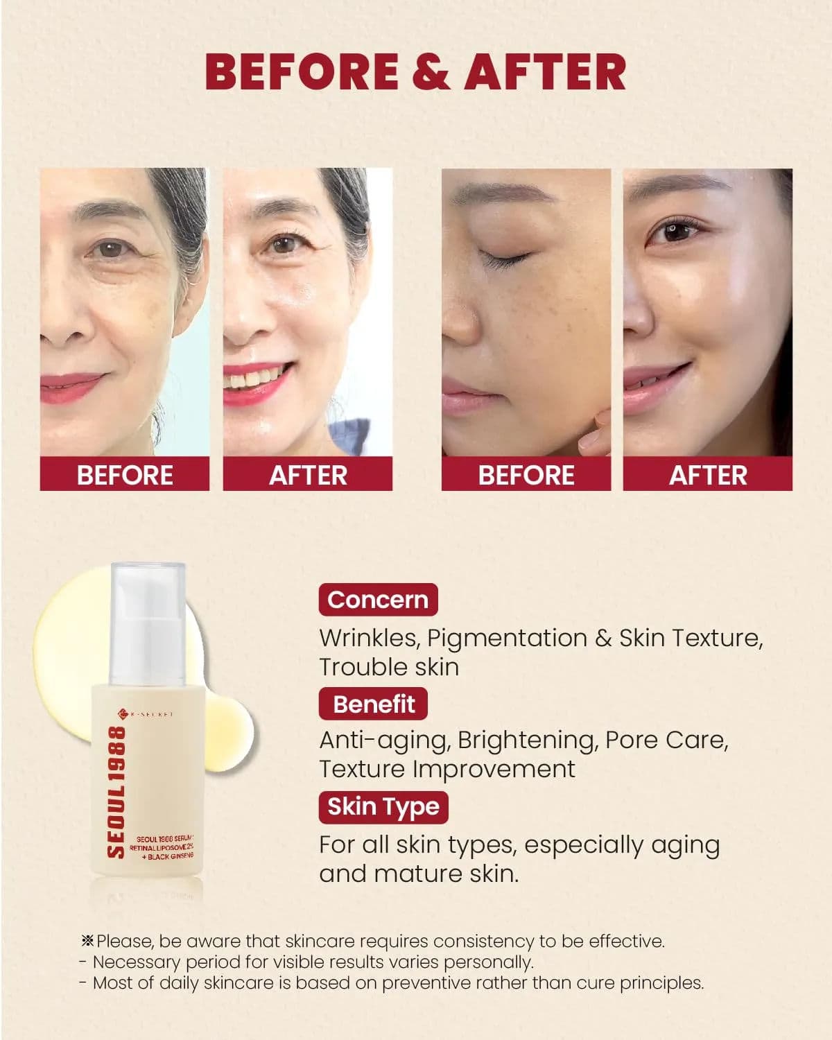 SEOUL 1988 Serum : Retinal Liposome 2% + Black Ginseng 3