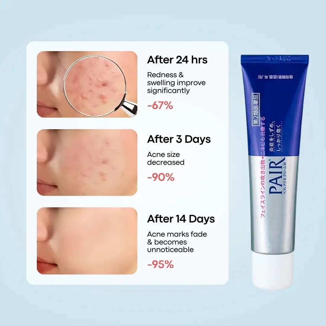 Pair Acne Cream W 3