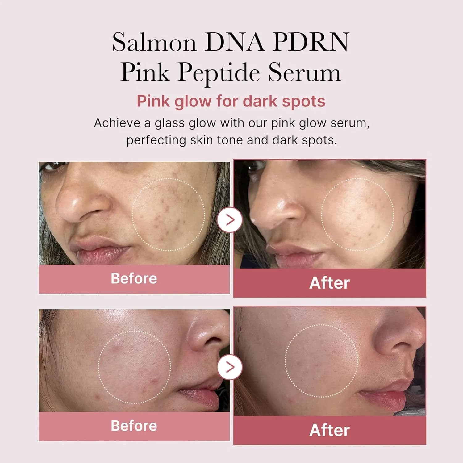 PDRN Pink Peptide Serum 5