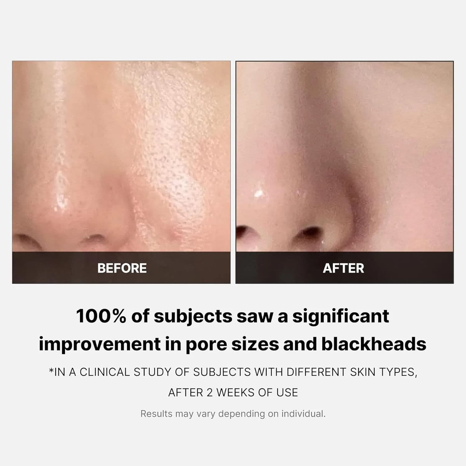 Zero Pore Pad 2.0 5