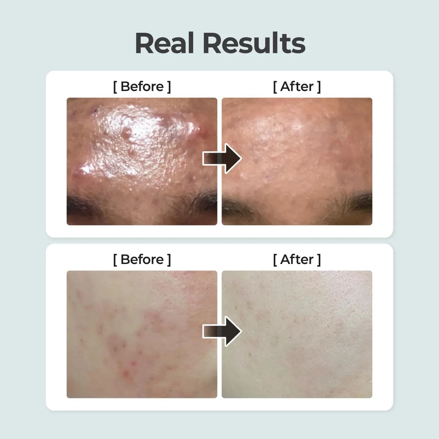 No.1 Pure-Full Calming Herb Toner 5