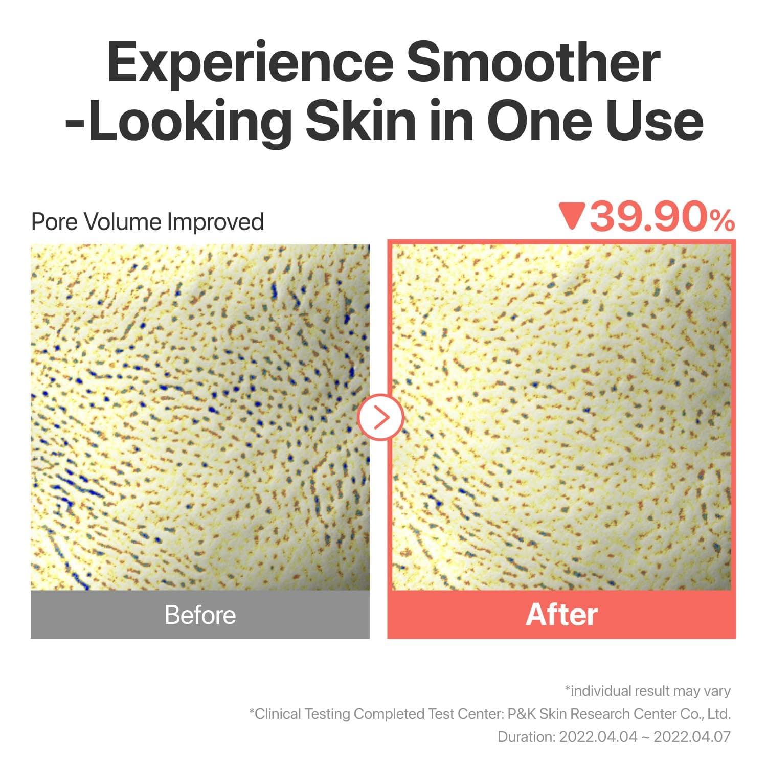 No. 3 Tingle-Pore Softening Sheet Mask 3