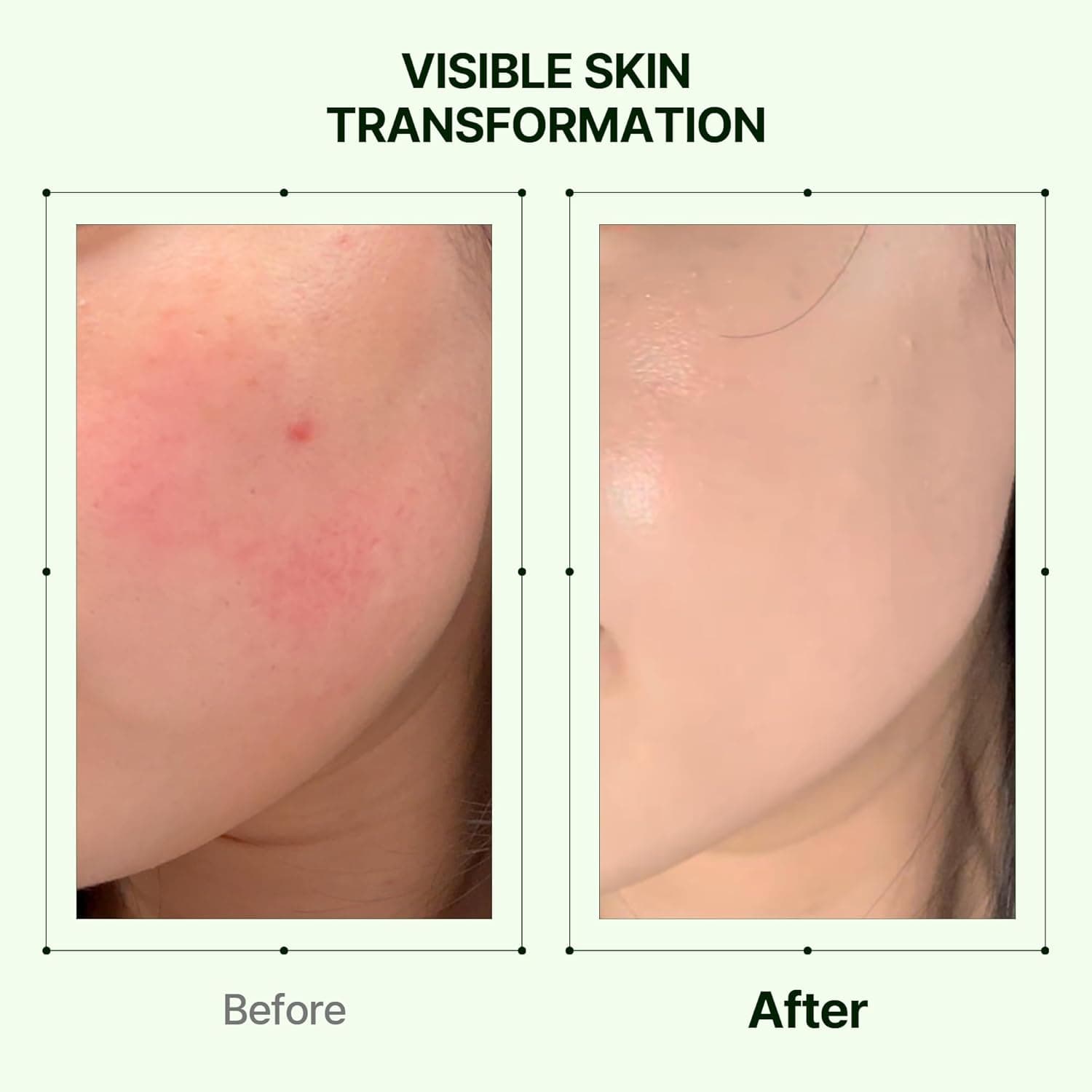 Mugwort Zero Film Moisturizer 5