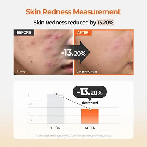 Carrot Carotene Calming Water Pad Set 60EA +Refill 30ea 5