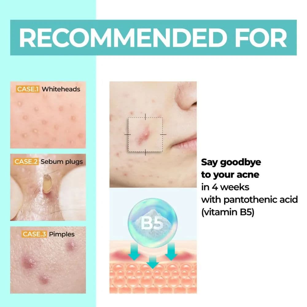 No.1 Pantothenic B5 Active Soothing Cream 3